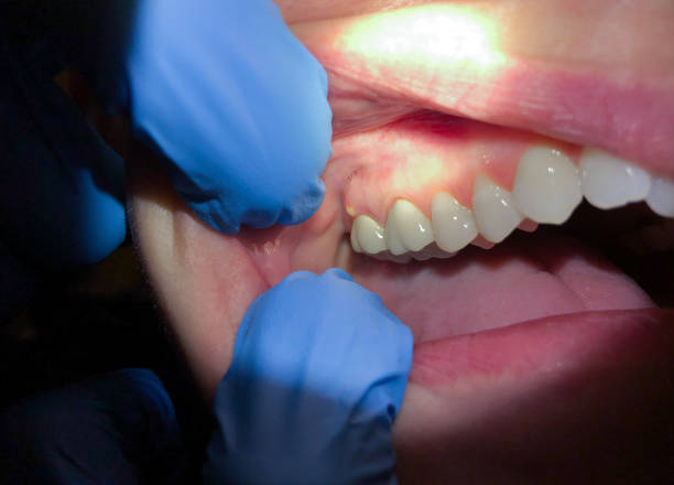 Best Emergency Dental Surgery in Marshallton, PA