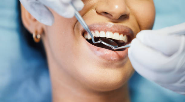 Best Emergency Wisdom Teeth Removal in Marshallton, PA